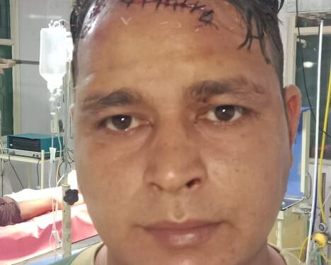 धारदार हथियार से तीन युवकों ने दो भाईयों पर किया हमला,मामले की जांच कर रही पुलिस………